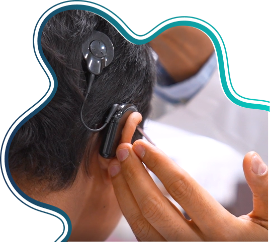 Audiologist fitting a cochlear implant sound processor on a patient
