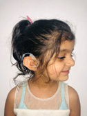 What is a Cochlear Implant
