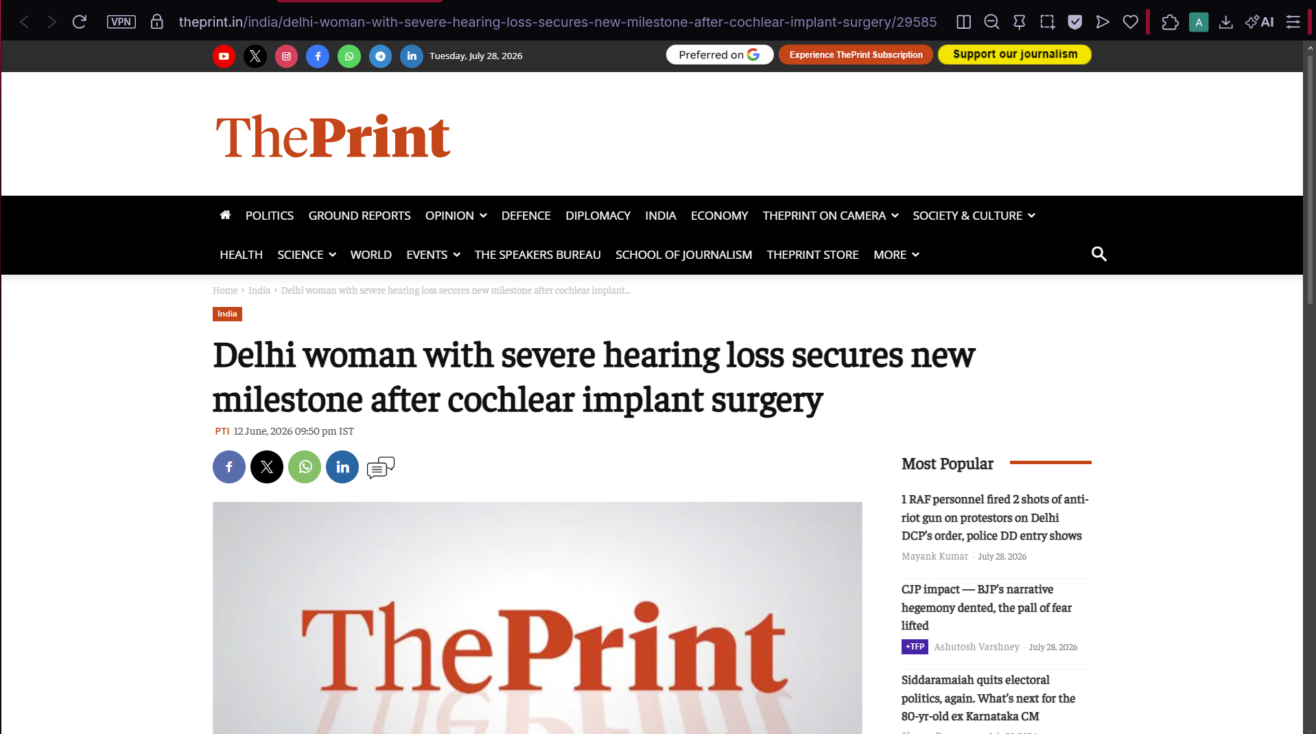 ThePrint report: Delhi woman with severe hearing loss secures a new milestone after cochlear implant surgery